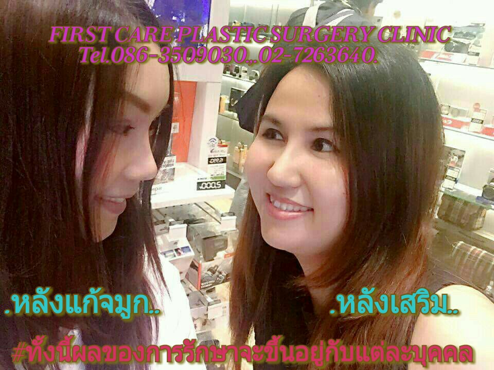 fixnosejob 7 m.jpg