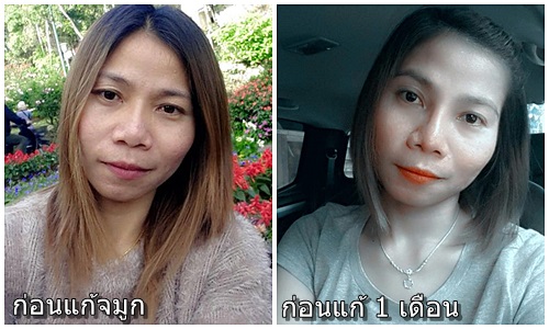 แก้ 1.jpg
