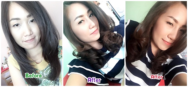 072015 nosejob 3 w.jpg