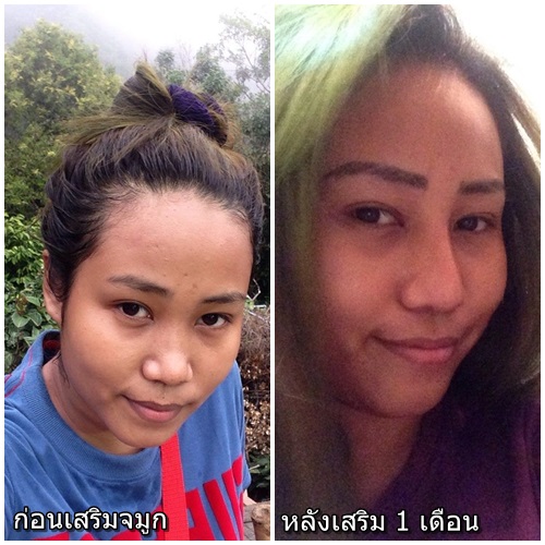 fix nose problem.jpg
