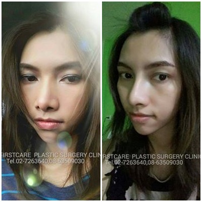 bf fixed nose 24 d.jpg